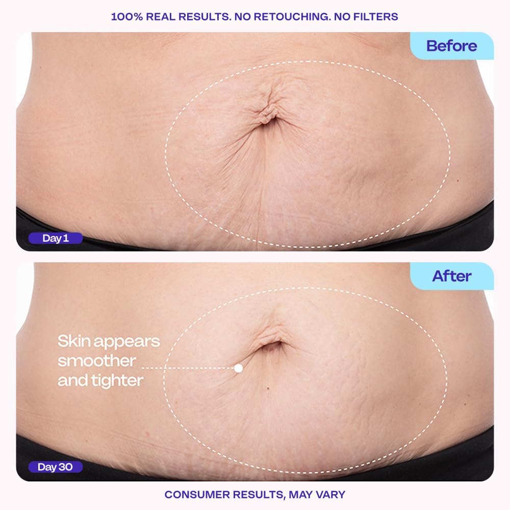 GOPURE Tighten & Smooth Belly Cream - Image 3
