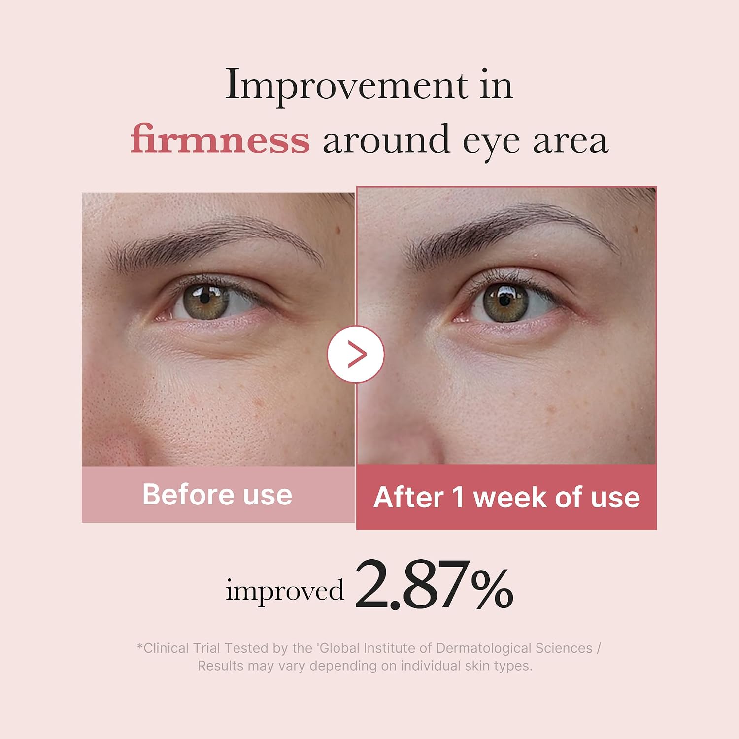 medicube Eye Serum - Image 4