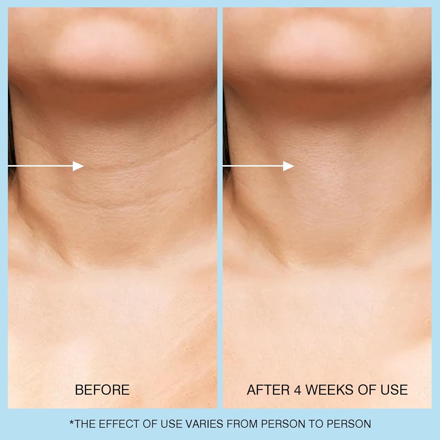 UJhay Retinol Neck Cream - Image 5