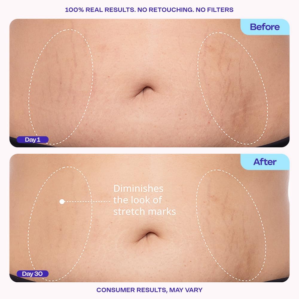 GOPURE Tighten & Smooth Belly Cream - Image 5
