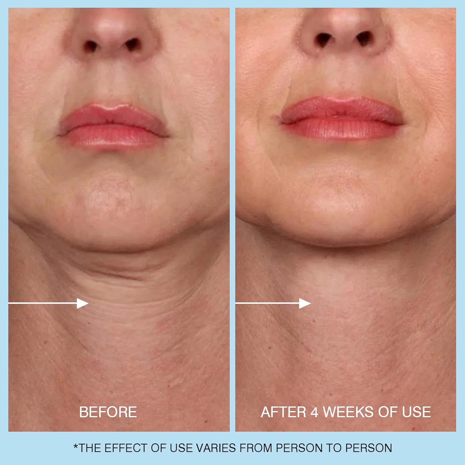 UJhay Retinol Neck Cream - Image 6