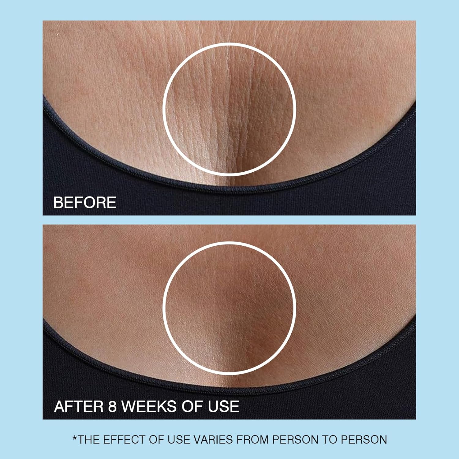 UJhay Retinol Neck Cream - Image 7